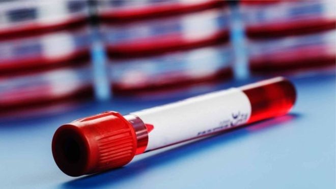 فيروس كورونا: حل لغز جهاز المناعة يبعث الأمل في التوصل لعلاج